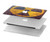 W3892 Nuclear Hazard Hard Case Cover For MacBook Pro Retina 13″ - A1425, A1502