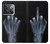 W1143 X-ray Hand Middle Finger Hard Case and Leather Flip Case For OnePlus Ace Pro