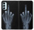 W1143 X-ray Hand Middle Finger Hard Case and Leather Flip Case For Samsung Galaxy M14