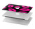 W2933 Pink Lips Kisses on Black Hard Case Cover For MacBook Air 15″ (2023,2024) - A2941, A3114