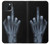 W1143 X-ray Hand Middle Finger Hard Case and Leather Flip Case For iPhone 15 Plus