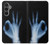 W3239 X-Ray Hand Sign OK Hard Case and Leather Flip Case For Samsung Galaxy S23 FE