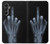 W1143 X-ray Hand Middle Finger Hard Case and Leather Flip Case For Samsung Galaxy A05s