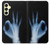 W3239 X-Ray Hand Sign OK Hard Case and Leather Flip Case For Samsung Galaxy A25 5G