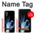 W3239 X-Ray Hand Sign OK Hard Case and Leather Flip Case For Samsung Galaxy Xcover7