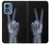 W3101 X-ray Peace Sign Fingers Hard Case and Leather Flip Case For Motorola Moto G Play 4G (2024)