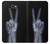 W3101 X-ray Peace Sign Fingers Hard Case and Leather Flip Case For Samsung Galaxy J7 Prime