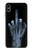 W1143 X-ray Hand Middle Finger Hard Case and Leather Flip Case For iPhone XS Max