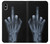 W1143 X-ray Hand Middle Finger Hard Case and Leather Flip Case For iPhone XS Max