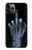 W1143 X-ray Hand Middle Finger Hard Case and Leather Flip Case For iPhone 11 Pro Max