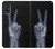 W3101 X-ray Peace Sign Fingers Hard Case and Leather Flip Case For Samsung Galaxy A51