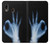 W3239 X-Ray Hand Sign OK Hard Case and Leather Flip Case For Samsung Galaxy A20, Galaxy A30