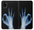 W3239 X-Ray Hand Sign OK Hard Case and Leather Flip Case For Samsung Galaxy A31