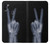 W3101 X-ray Peace Sign Fingers Hard Case and Leather Flip Case For Samsung Galaxy M11