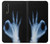 W3239 X-Ray Hand Sign OK Hard Case and Leather Flip Case For LG Velvet