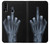 W1143 X-ray Hand Middle Finger Hard Case and Leather Flip Case For Samsung Galaxy A20s