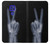 W3101 X-ray Peace Sign Fingers Hard Case and Leather Flip Case For Motorola Moto G9 Play