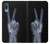 W3101 X-ray Peace Sign Fingers Hard Case and Leather Flip Case For Samsung Galaxy A04, Galaxy A02, M02