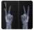 W3101 X-ray Peace Sign Fingers Hard Case and Leather Flip Case For LG Stylo 7 5G