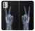 W3101 X-ray Peace Sign Fingers Hard Case and Leather Flip Case For Motorola Moto G Stylus (2021)