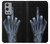 W1143 X-ray Hand Middle Finger Hard Case and Leather Flip Case For OnePlus 9 Pro