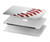 W1842 New Baseball Hard Case Cover For MacBook Air 13″ - A1932, A2179, A2337