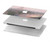 W1443 Terrace in Paris Eifel Hard Case Cover For MacBook Pro 13″ - A1706, A1708, A1989, A2159, A2289, A2251, A2338