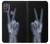 W3101 X-ray Peace Sign Fingers Hard Case and Leather Flip Case For Motorola Moto G10 Power