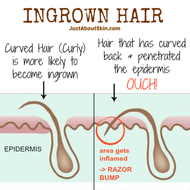 6 Tips for Reducing Razor Bumps & Ingrown Hairs When Shaving  