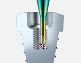 Thread Mills for Dental Implants