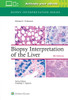 Biopsy Interpretation Of The Liver