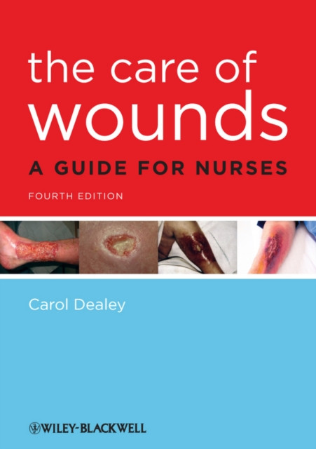 The Care Of Wounds A Guide For Nurses Carol Dealey 9781405195690