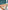 Contemporary Oral and Maxillofacial Surgery