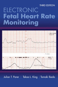 Electronic Fetal Heart Rate Monitoring