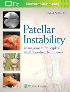 Patellar Instability: Management Principles And Operative Techniques Patellar Instability: Management Principles And Operative Techniques