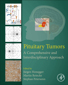 Pituitary Tumors: A Comprehensive And Interdisciplinary Approach