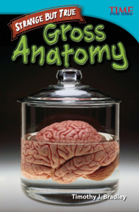 Strange but True: Gross Anatomy Strange but True: Gross Anatomy