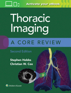 Thoracic Imaging: A Core Review Thoracic Imaging: A Core Review