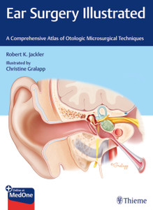 Ear Surgery Illustrated : A Comprehensive Atlas of Otologic Microsurgical Techniques Ear Surgery Illustrated : A Comprehensive Atlas of Otologic Microsurgical Techniques