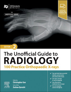 The Unofficial Guide to Radiology: 100 Practice Orthopaedic X-Rays The Unofficial Guide to Radiology: 100 Practice Orthopaedic X-Rays