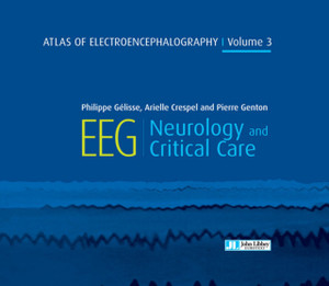 Atlas of Electroencephalography Volume 3 : EEG Neurology and Critical Care Atlas of Electroencephalography Volume 3 : EEG Neurology and Critical Care