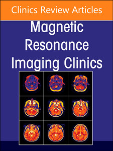 MR Imaging of the Adnexa, An Issue of Magnetic Resonance Imaging Clinics of North America MR Imaging of the Adnexa, An Issue of Magnetic Resonance Imaging Clinics of North America