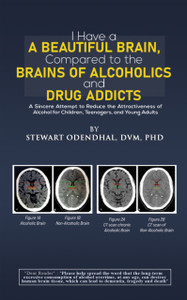 I Have a Beautiful Brain, Compared to the Brains of Alcoholics and Drug Addicts: A Sincere Attempt to Reduce the Attractiveness of Alcohol for Children, Teenagers, and Young Adults