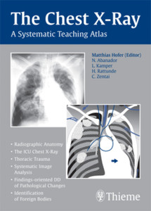 The Chest X-Ray: A Systematic Teaching Atlas The Chest X-Ray: A Systematic Teaching Atlas