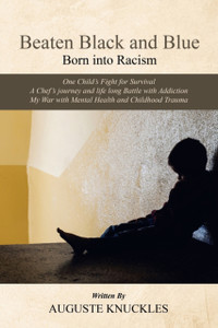 Beaten Black And Blue: Born Into Racism - 9781665580229 Beaten Black And Blue: Born Into Racism - 9781665580229