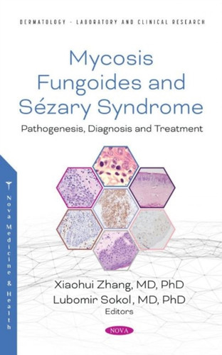 Mycosis Fungoides and Sezary Syndrome : Pathogenesis, Diagnosis and Treatment