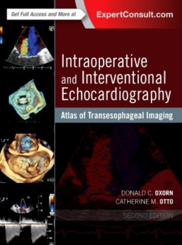 Intraoperative and Interventional Echocardiography : Atlas of Transesophageal Imaging