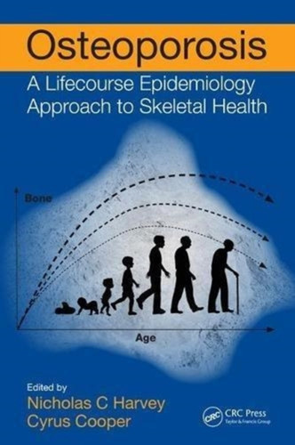 Osteoporosis : A Lifecourse Epidemiology Approach to Skeletal Health