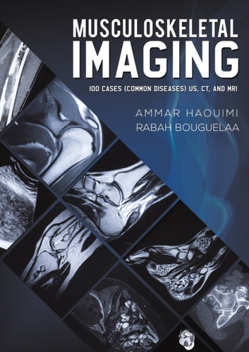 Musculoskeletal Imaging: 100 Cases (Common Diseases) Us, Ct And Mri