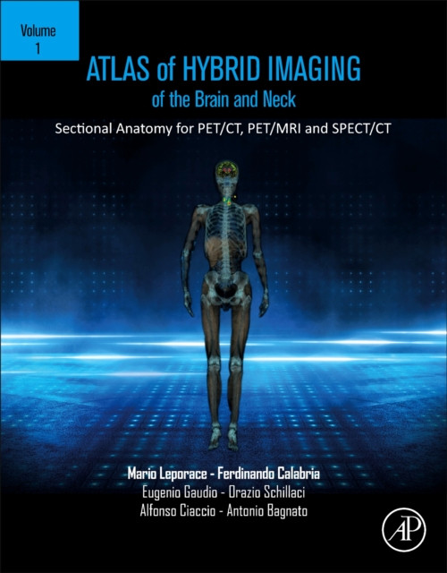 Atlas of Hybrid Imaging of the Brain and Neck, Volume 1 : Sectional Anatomy for PET/CT, PET/MRI and SPECT/CT